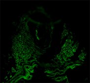 Anti-Cytokeratin pan-FITC antibody, Mouse monoclonal clone PCK-26, purified from hybridoma cell culture