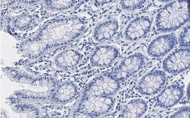 Anti-NME1 Antibody, clone 1H15 ZooMAb® Rabbit Monoclonal recombinant, expressed in HEK 293 cells