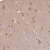 Anti-PLCB1 antibody produced in rabbit Prestige Antibodies® Powered by Atlas Antibodies, affinity isolated antibody, buffered aqueous glycerol solution