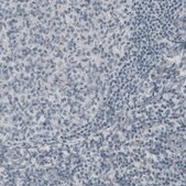 Monoclonal Anti-NEFH antibody produced in mouse Prestige Antibodies® Powered by Atlas Antibodies, clone CL2671, purified immunoglobulin, buffered aqueous glycerol solution