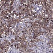 ANTI-MAGEB1 antibody produced in rabbit Prestige Antibodies® Powered by Atlas Antibodies, affinity isolated antibody, buffered aqueous glycerol solution