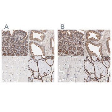 Anti-PDIA3 antibody produced in rabbit Ab2, Prestige Antibodies® Powered by Atlas Antibodies, affinity isolated antibody, buffered aqueous glycerol solution