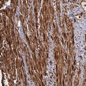 Anti-VCL antibody produced in rabbit Prestige Antibodies® Powered by Atlas Antibodies, affinity isolated antibody, buffered aqueous glycerol solution