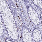 Anti-IL2RB antibody produced in rabbit Prestige Antibodies® Powered by Atlas Antibodies, affinity isolated antibody, buffered aqueous glycerol solution