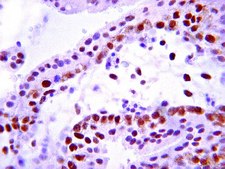 Anti-Insulin Receptor Antibody, beta subunit, clone CT-3 clone CT-3, from mouse