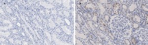 Anti-c-Myc Antibody, clone 7E18, ZooMAb® Rabbit Monoclonal recombinant, expressed in HEK 293 cells