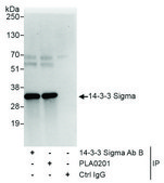 Rabbit anti-14-3-3 Sigma Antibody, Affinity Purified Powered by Bethyl Laboratories, Inc.