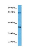 抗 TNNT2 兔抗 affinity isolated antibody