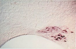 Anti-Nerve Growth Factor Receptor Antibody, extracellular, clone 192-IgG clone 192-IgG, Chemicon®, from mouse