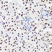 Anti-UAP56/DDX39B antibody produced in rabbit