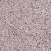 Anti-GBE1 antibody produced in rabbit Prestige Antibodies® Powered by Atlas Antibodies, affinity isolated antibody, buffered aqueous glycerol solution