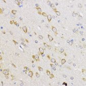 Anti-BCL2 antibody produced in rabbit