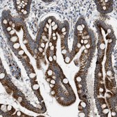 Anti-TPH1 antibody produced in rabbit Prestige Antibodies® Powered by Atlas Antibodies, affinity isolated antibody, buffered aqueous glycerol solution