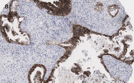 Anti-EpCAM Antibody, clone 1B8 , ZooMAb® Rabbit Monoclonal recombinant, expressed in HEK 293 cells