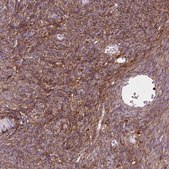 Anti-DCN antibody produced in rabbit Prestige Antibodies® Powered by Atlas Antibodies, affinity isolated antibody