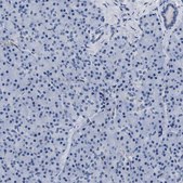 Anti-ADH4 antibody produced in rabbit Prestige Antibodies® Powered by Atlas Antibodies, affinity isolated antibody, buffered aqueous glycerol solution