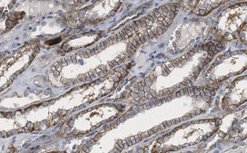 Anti-ADAM10 Antibody, clone 1F3 ZooMAb® Rabbit Monoclonal recombinant, expressed in HEK 293 cells