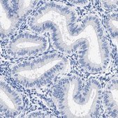 抗-HOOK1 兔抗 Prestige Antibodies® Powered by Atlas Antibodies, affinity isolated antibody, buffered aqueous glycerol solution, Ab1