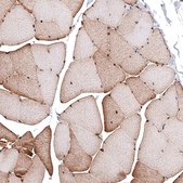 Anti-LMO7 antibody produced in rabbit Prestige Antibodies® Powered by Atlas Antibodies, affinity isolated antibody, buffered aqueous glycerol solution