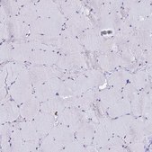 Anti-ACTL6B antibody produced in rabbit Prestige Antibodies® Powered by Atlas Antibodies, affinity isolated antibody, buffered aqueous glycerol solution