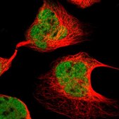 Anti-EP300 antibody produced in rabbit Ab2, Prestige Antibodies® Powered by Atlas Antibodies, affinity isolated antibody, buffered aqueous glycerol solution