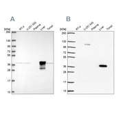 Anti-ADH6 Prestige Antibodies® Powered by Atlas Antibodies, affinity isolated antibody