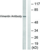 Anti-Vimentin antibody produced in rabbit affinity isolated antibody