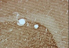 Anti-CNPase Antibody, clone 11-5B clone 11-5B, Chemicon®, from mouse