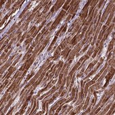 Anti-OXCT1 antibody produced in rabbit Prestige Antibodies® Powered by Atlas Antibodies, affinity isolated antibody, buffered aqueous glycerol solution