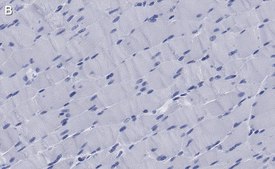 Anti-MYH1 Antibody, clone 1E15 , ZooMAb® Rabbit Monoclonal recombinant, expressed in HEK 293 cells