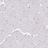 Anti-CFH antibody produced in rabbit Prestige Antibodies® Powered by Atlas Antibodies, affinity isolated antibody, buffered aqueous glycerol solution