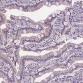 Anti-SLC40A1 antibody produced in rabbit Prestige Antibodies® Powered by Atlas Antibodies, affinity isolated antibody, buffered aqueous glycerol solution