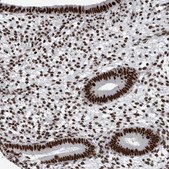 Anti-DNMT3A antibody produced in rabbit Prestige Antibodies® Powered by Atlas Antibodies, affinity isolated antibody, buffered aqueous glycerol solution