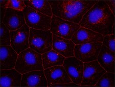 抗-封闭素抗体 来源于兔 affinity isolated antibody