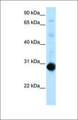 Anti-NR0B2 (ab4) antibody produced in rabbit affinity isolated antibody
