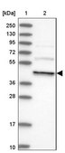 Anti-DCTN4 antibody produced in rabbit Prestige Antibodies® Powered by Atlas Antibodies, affinity isolated antibody, buffered aqueous glycerol solution