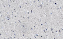 Anti-β-NGF Antibody, clone 1F18 ZooMAb® Rabbit Monoclonal recombinant, expressed in HEK 293 cells