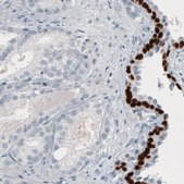 Monoclonal Anti-TP63 antibody produced in mouse Prestige Antibodies® Powered by Atlas Antibodies, clone CL3748, purified immunoglobulin, buffered aqueous glycerol solution