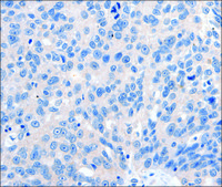 Anti-GRIN2D antibody produced in rabbit affinity isolated antibody
