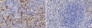 Anti-RANTES Antibody, clone 1K17 ZooMAb® Rabbit Monoclonal recombinant, expressed in HEK 293 cells
