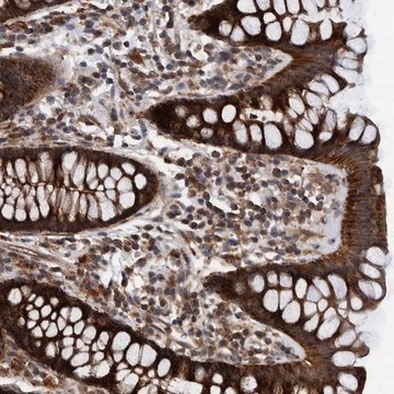 Anti-MRPS7 antibody produced in rabbit Prestige Antibodies® Powered by Atlas Antibodies, affinity isolated antibody, buffered aqueous glycerol solution, Ab2