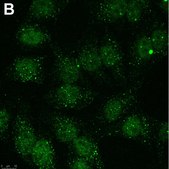 Anti-Linear Ubiquitin Antibody, clone 1E3 ZooMAb® Rabbit Monoclonal recombinant, expressed in HEK 293 cells