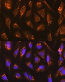 Anti-TFAM antibody produced in rabbit