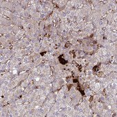 Anti-F2 antibody produced in rabbit Prestige Antibodies® Powered by Atlas Antibodies, affinity isolated antibody, buffered aqueous glycerol solution