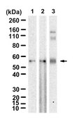 Anti-CRFR1/CRHR1 Antibody, clone 1N21 ZooMAb® Rabbit Monoclonal recombinant, expressed in HEK 293 cells