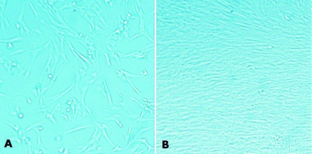 MaxGel™ ECM mixture, liquid