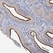 Anti-SLC9A3 antibody produced in rabbit Prestige Antibodies® Powered by Atlas Antibodies, affinity isolated antibody, buffered aqueous glycerol solution