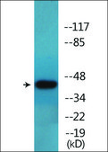 Anti-phospho-Casein Kinase II α (pTyr255) antibody produced in rabbit affinity isolated antibody