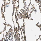 Anti-SPTBN1 antibody produced in rabbit Prestige Antibodies® Powered by Atlas Antibodies, affinity isolated antibody, buffered aqueous glycerol solution