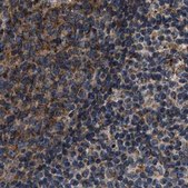 Anti-KTN1 antibody produced in rabbit Prestige Antibodies® Powered by Atlas Antibodies, affinity isolated antibody, buffered aqueous glycerol solution